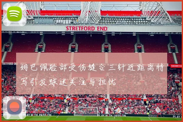 姆巴佩脸部受伤缝合三针近距离特写引发球迷关注与担忧